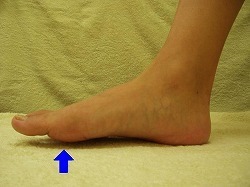 外反母趾など足のトラブル・みどり整体院